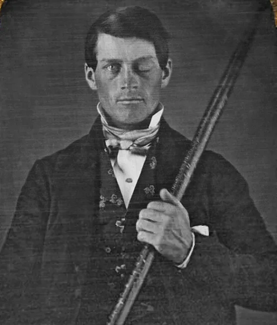 portret phineasa gage